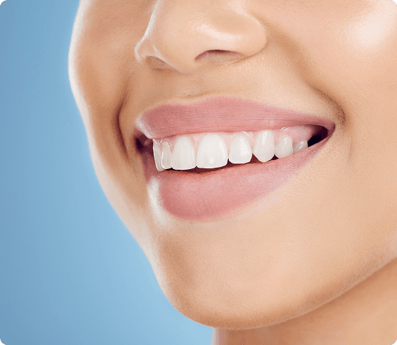 Woman with beautiful smile - Digital Smile Makeover result