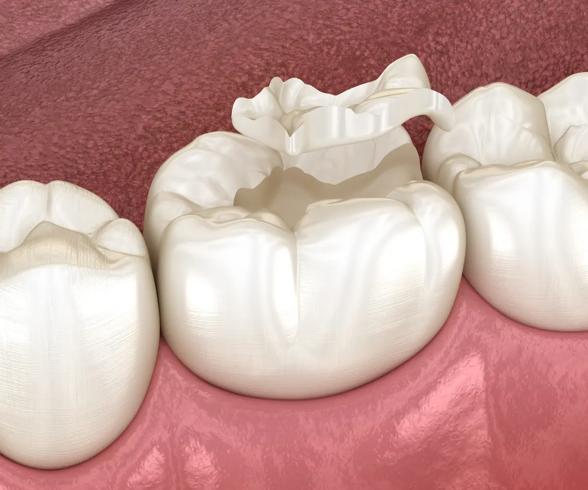 Dental professional examining a patient for cracked tooth symptoms using clinical instruments