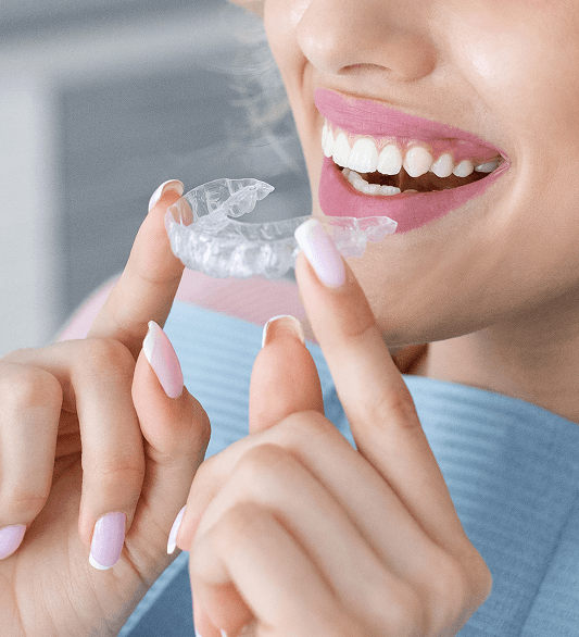 Clear aligner treatment results