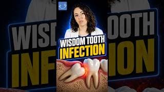 Signs You Have A Wisdom Tooth Infection!
