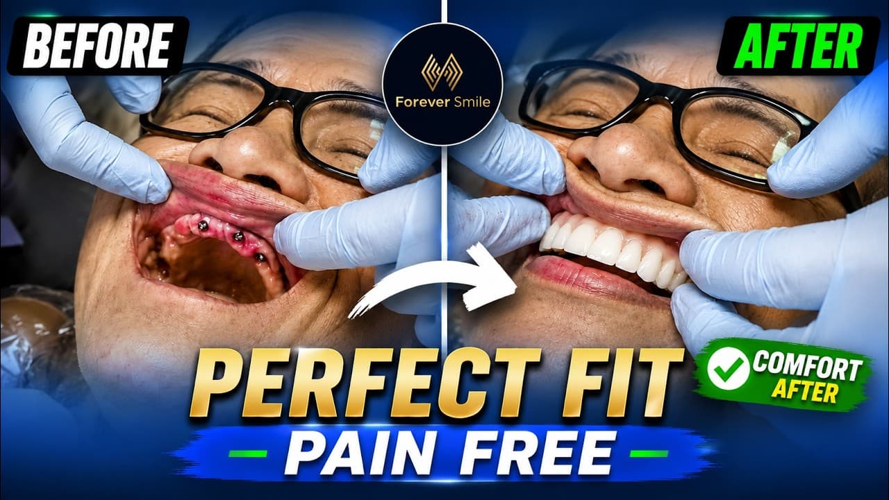 Effortless Smile on Your Mind? Watch the Magic Behind The Transformation!