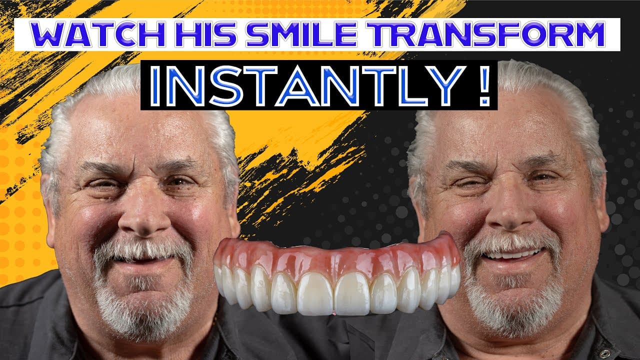 Will My Smile Be Transformed Forever?